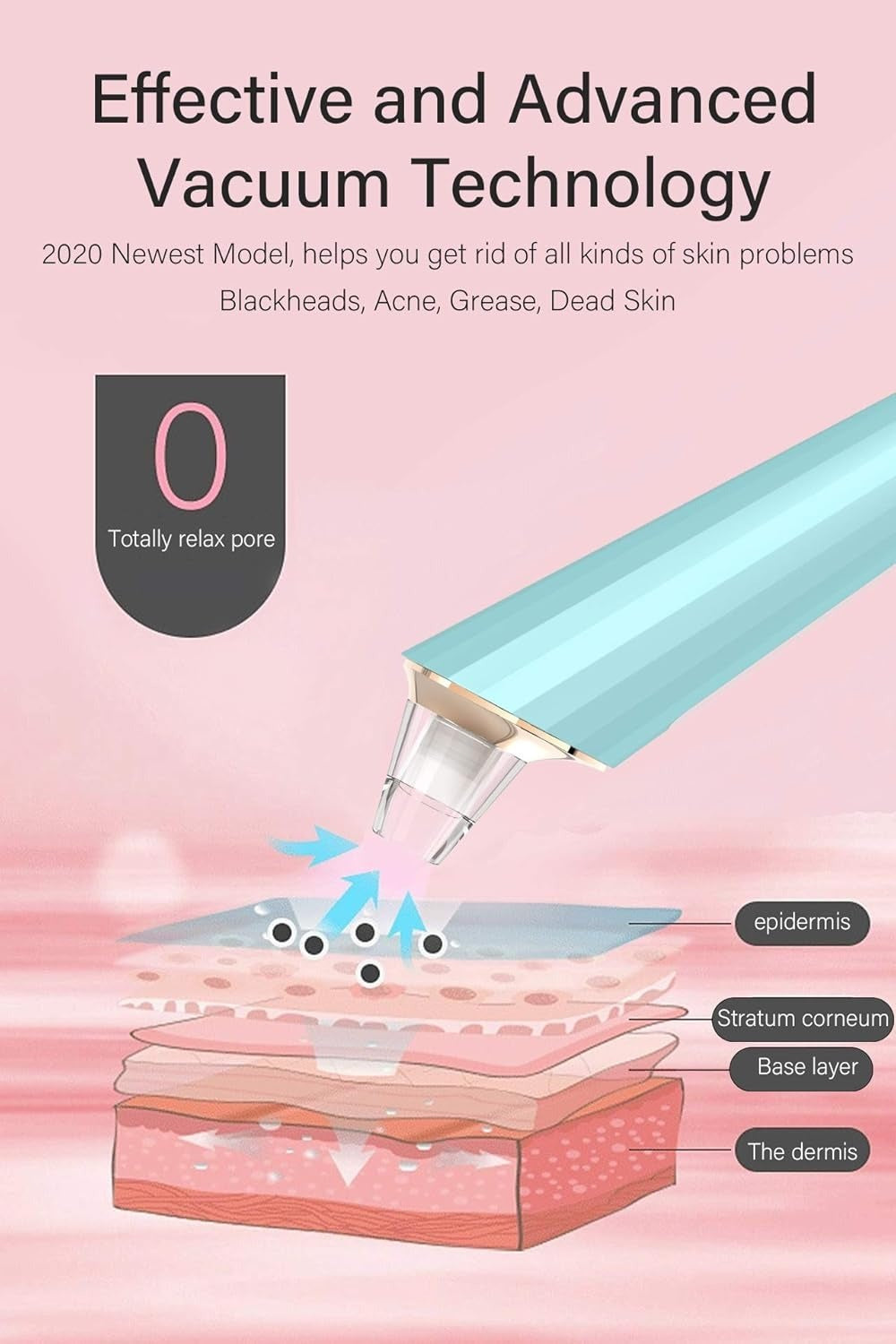 Electric Blackhead Acne