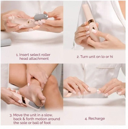 Foot Callus Remover